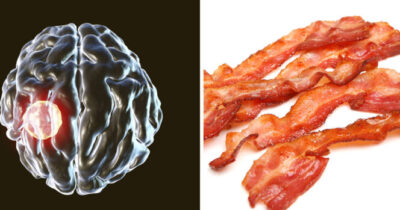 Le cerveau et des morceaux de bacon